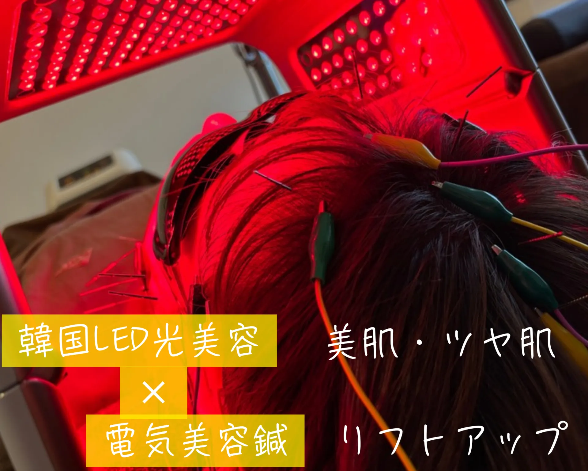 LEDライト×電気美容鍼