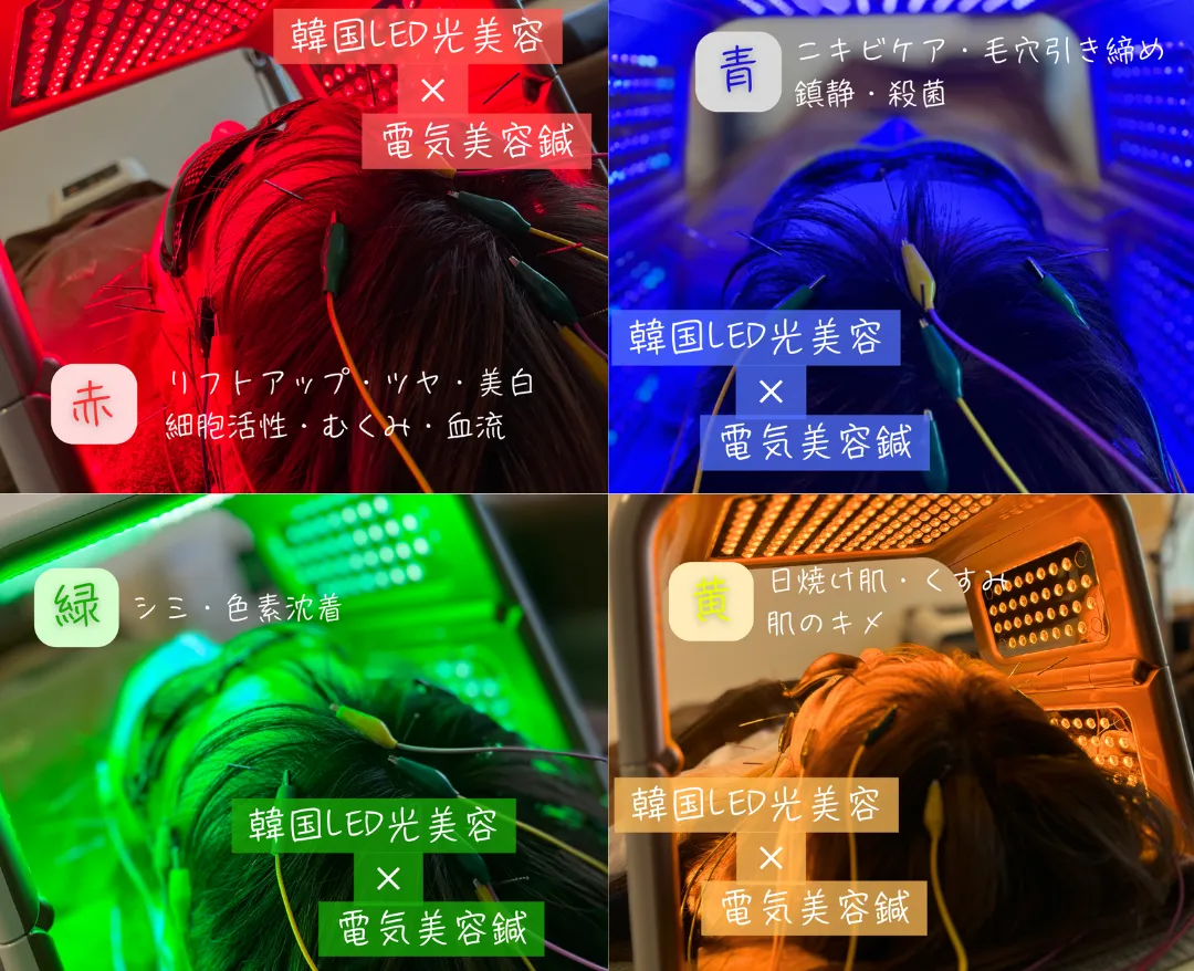 美肌美髪LEDライト×お顔と頭皮引き上げ電気美容鍼
