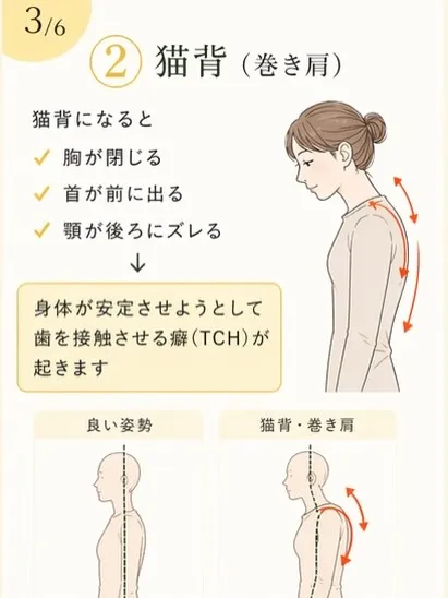 食いしばり、気づいていますか？😳