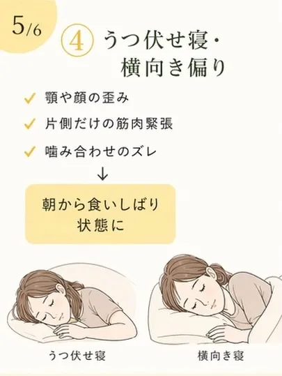 食いしばり、気づいていますか？😳