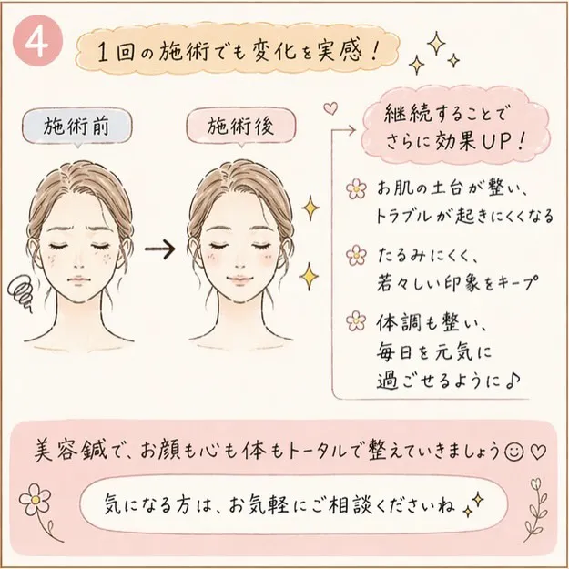 「美容鍼って実際どう変わるの？」